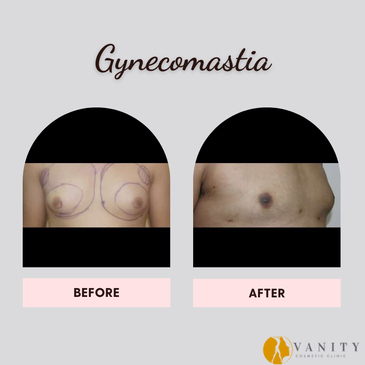 Slider image (8) Vanity Cosmetic Clinic